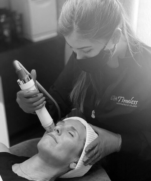 Let’s Face it: Microneedling RF is Revolutionary